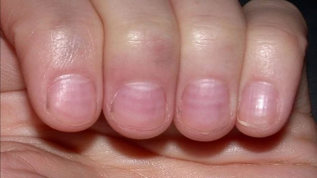 Подробнее о статье Полумесяцем или с уголками: как правильно стричь ногти? — новости медицины